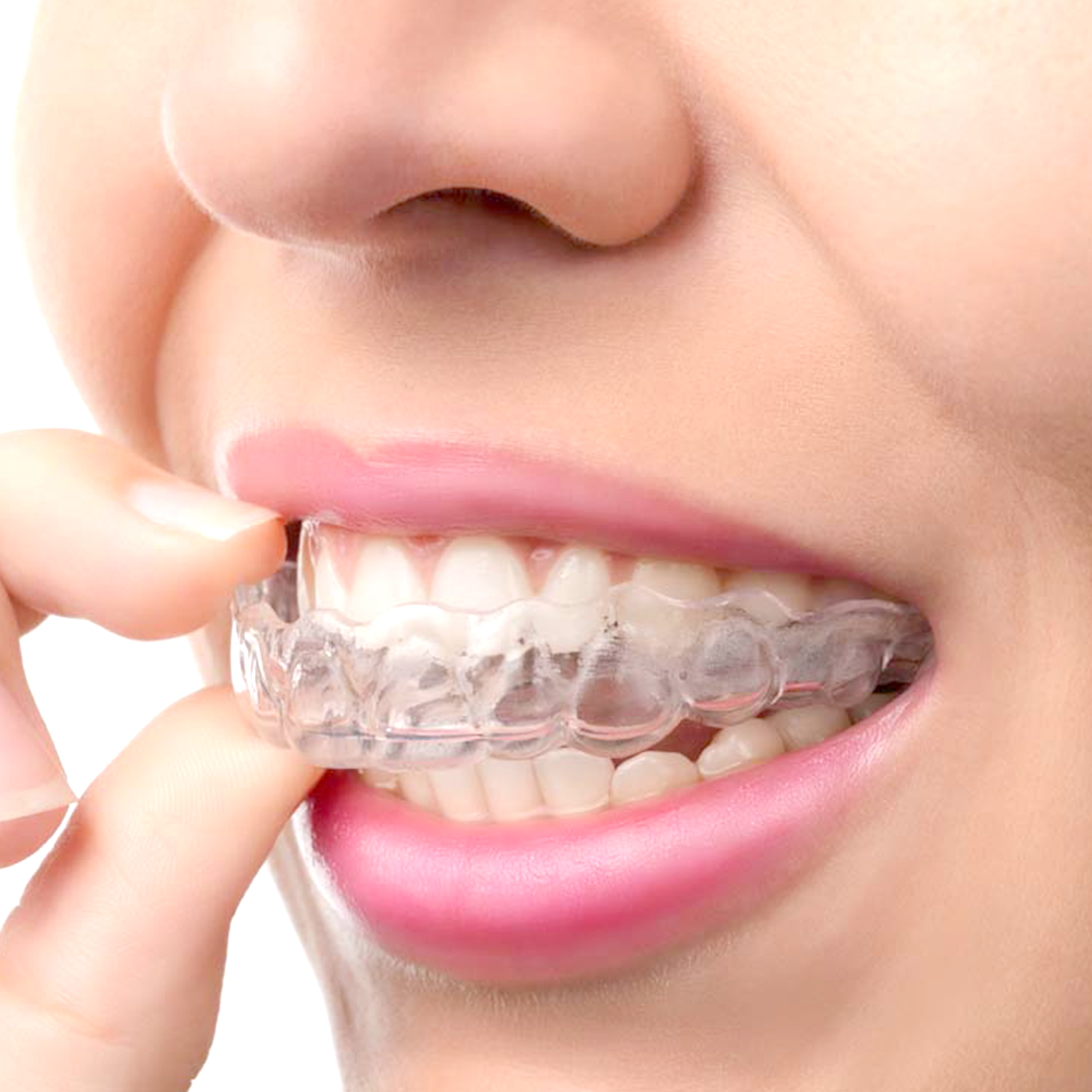 1Pc/2Pcs Transparent Teeth Tra - Teeth Whitening With Trays recensie en prijs