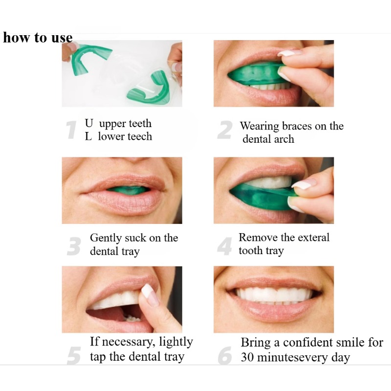 Set Teeth Whitening Tray U-sha - Teeth Whitening With Trays recensie en prijs
