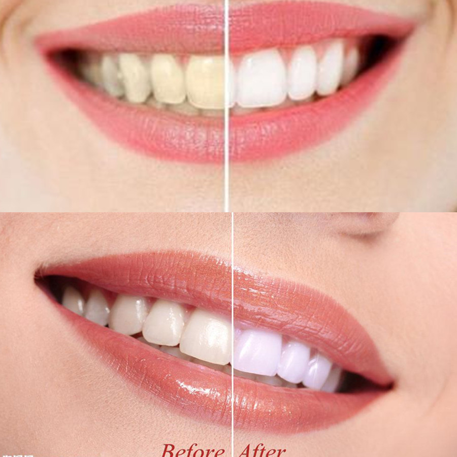 Bamboo Charcoal Teeth Tooth De - Teeth Whitening Ai recensie en prijs