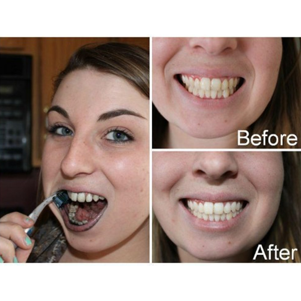 Bamboo Charcoal Teeth Tooth De - Teeth Whitening Ai recensie en prijs