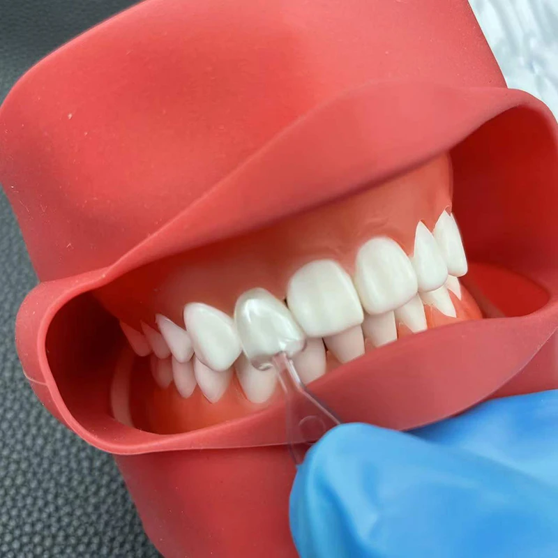 1Set/3Set/5Set Dental Veneer M - Teeth Whitening Moulds recensie en prijs