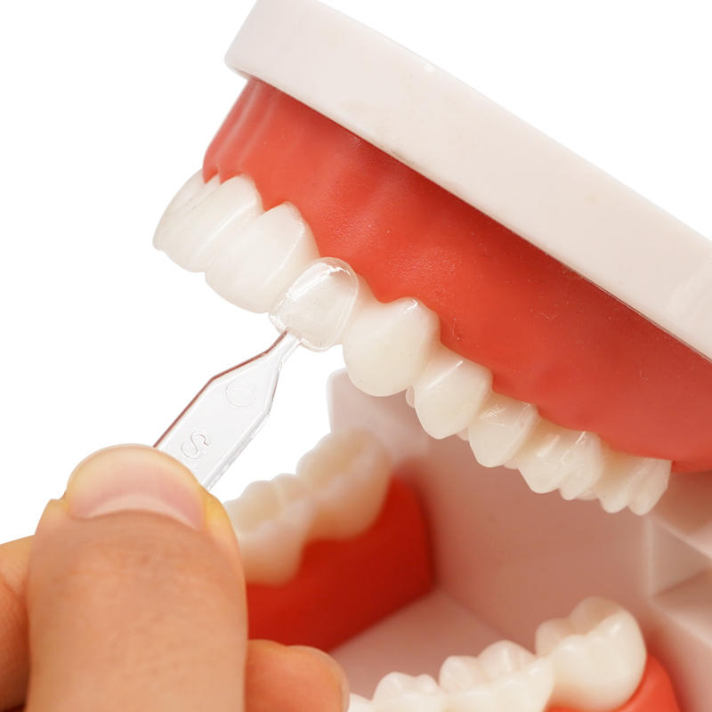 30Pcs Dental Veneers Mould Kit - Teeth Whitening Moulds recensie en prijs