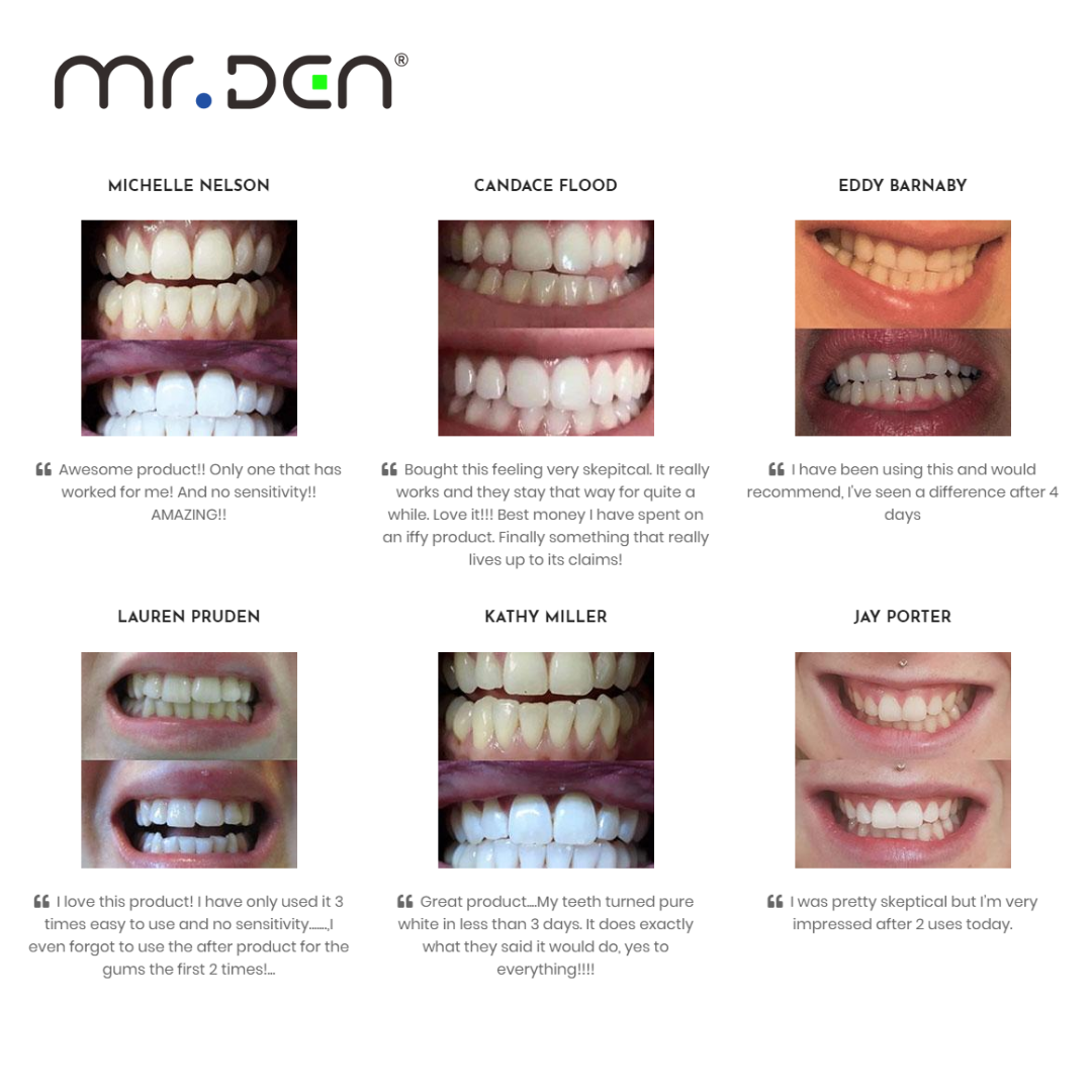 Dr. Whiten 3 Pack Teeth Whiten - Whitening Teeth Machine recensie en prijs