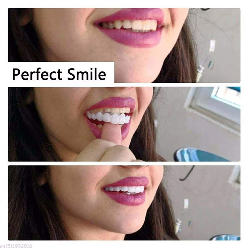 Veneer Snap-on Teeth Kit Fake  - Teeth Whitening Session recensie en prijs