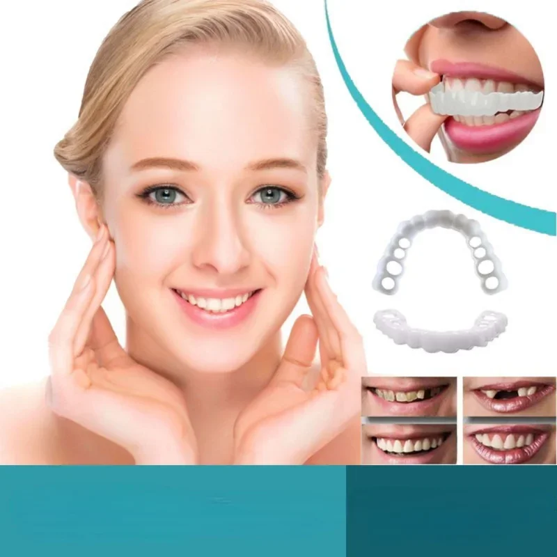 Denture Cover Veneer Snap-on T - Teeth Whitening Session recensie en prijs
