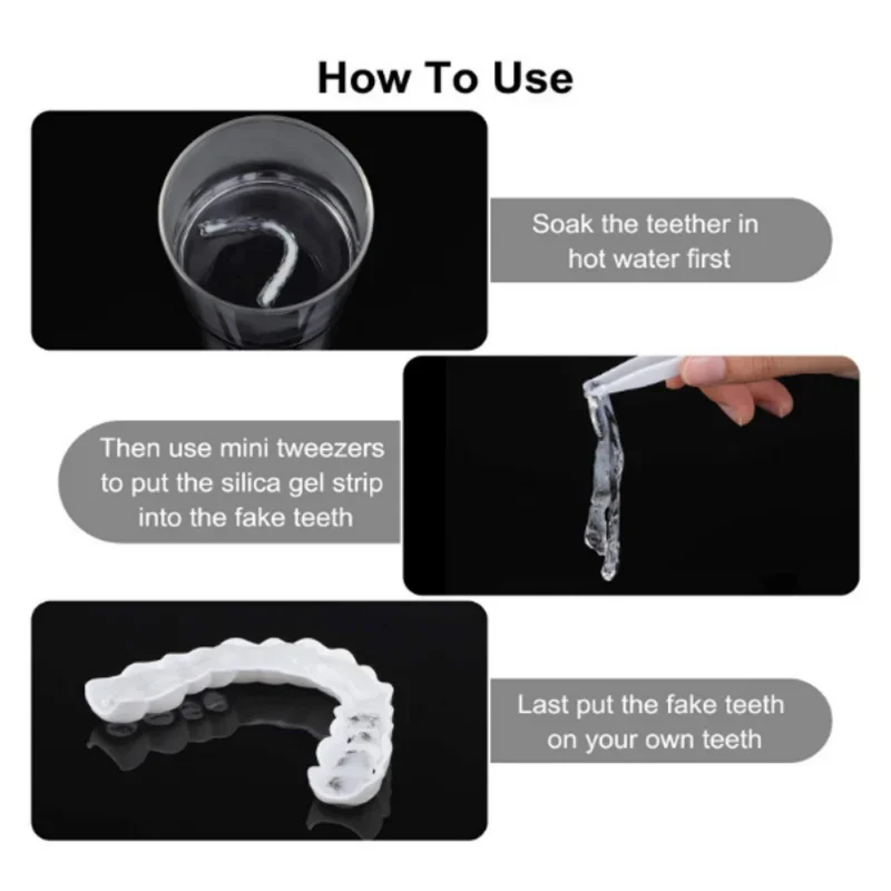 Denture Cover Veneer Snap-on T - Teeth Whitening Session recensie en prijs