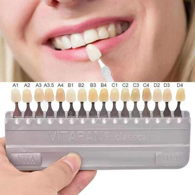 VITA 16 Colors Teeth Shade Gui - Teeth Whitening With Trays recensie en prijs