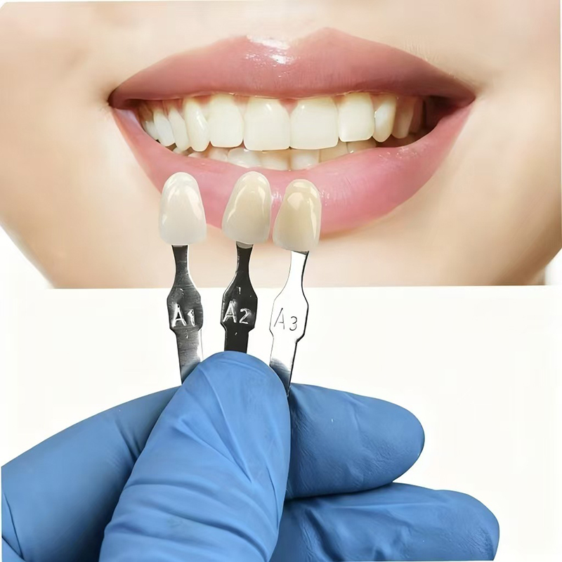 VITA 16 Colors Teeth Shade Gui - Teeth Whitening With Trays recensie en prijs
