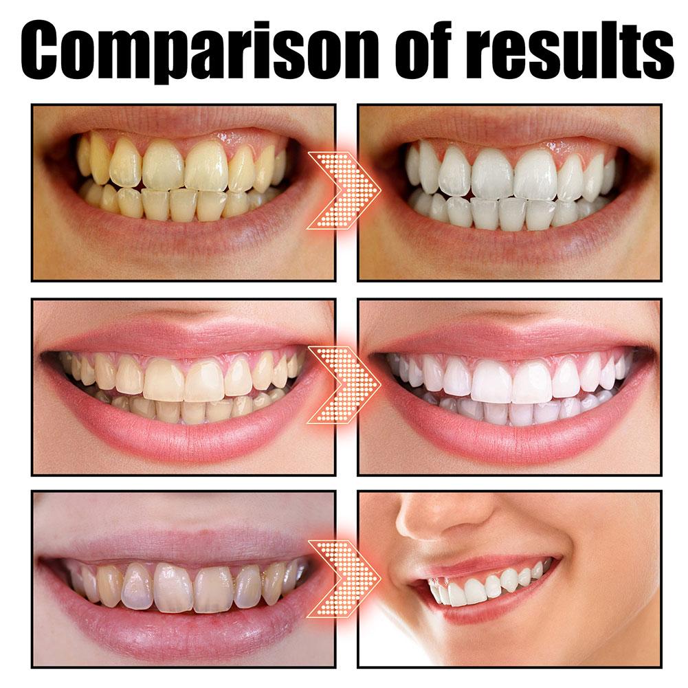 Coconut Mint Pulling Oil Mouth - Teeth Whitening Oil Pulling recensie en prijs
