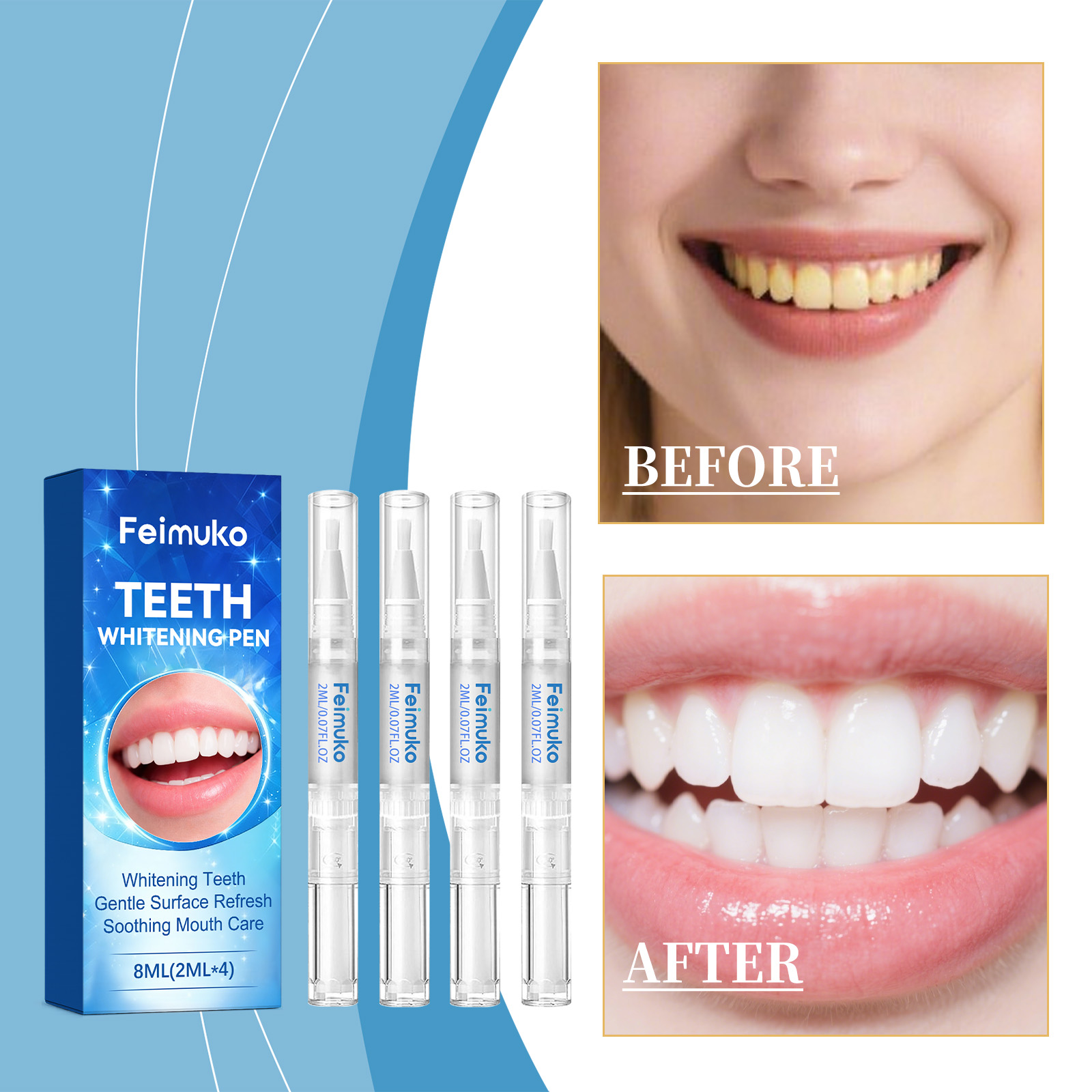 Feimuko 8ml Teeth Gel Pen Gent - Teeth Whitening Near Me recensie en prijs