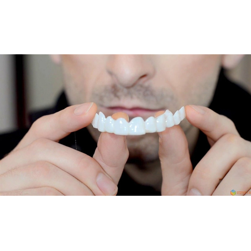 Soft Silicone Gel Dental Oral  - Teeth Whitening Moulds recensie en prijs