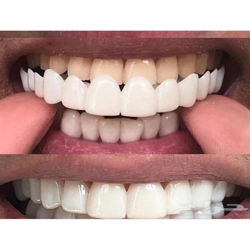 Soft Silicone Gel Dental Oral  - Teeth Whitening Moulds recensie en prijs