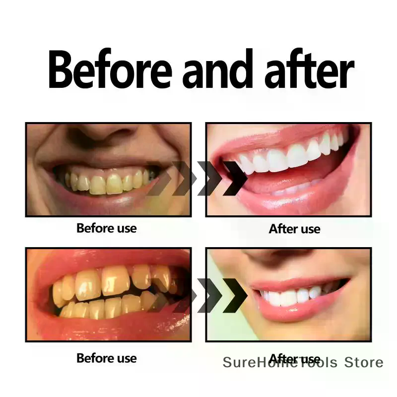 Bamboo Charcoal Powder For Tee - Teeth Whitening Near Me recensie en prijs