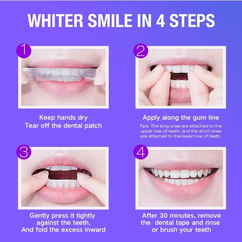 Teeth Whitening Kit - 5X LED L - Teeth Whitening Ai recensie en prijs