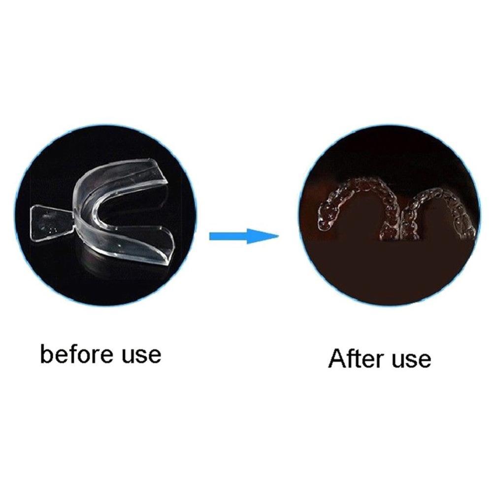 Silicone Mouth Guard Orthodont - Teeth Whitening With Trays recensie en prijs