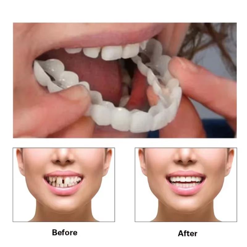 Best Sellers  Teeth Kit Fake T - Teeth Whitening Session recensie en prijs