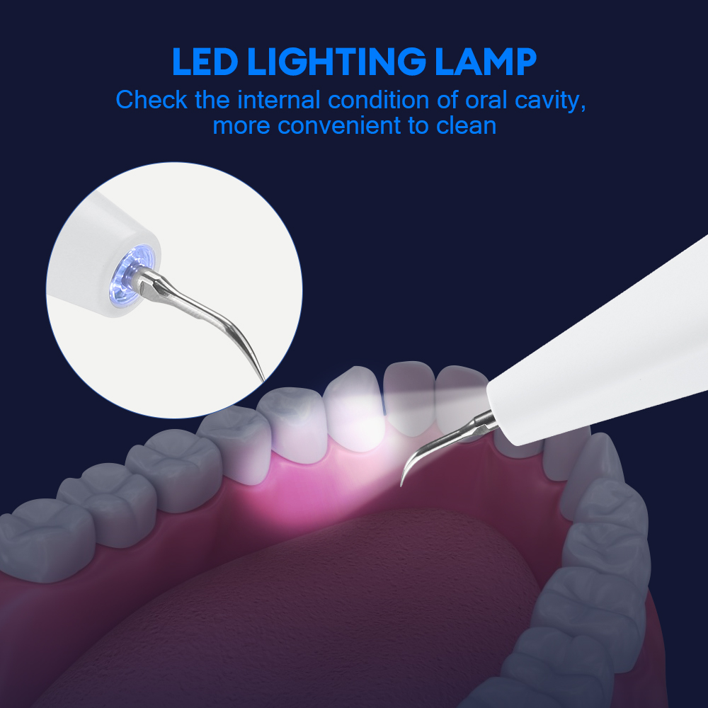 Ultrasonic Dental Calculus Rem - Teeth Whitening Express recensie en prijs
