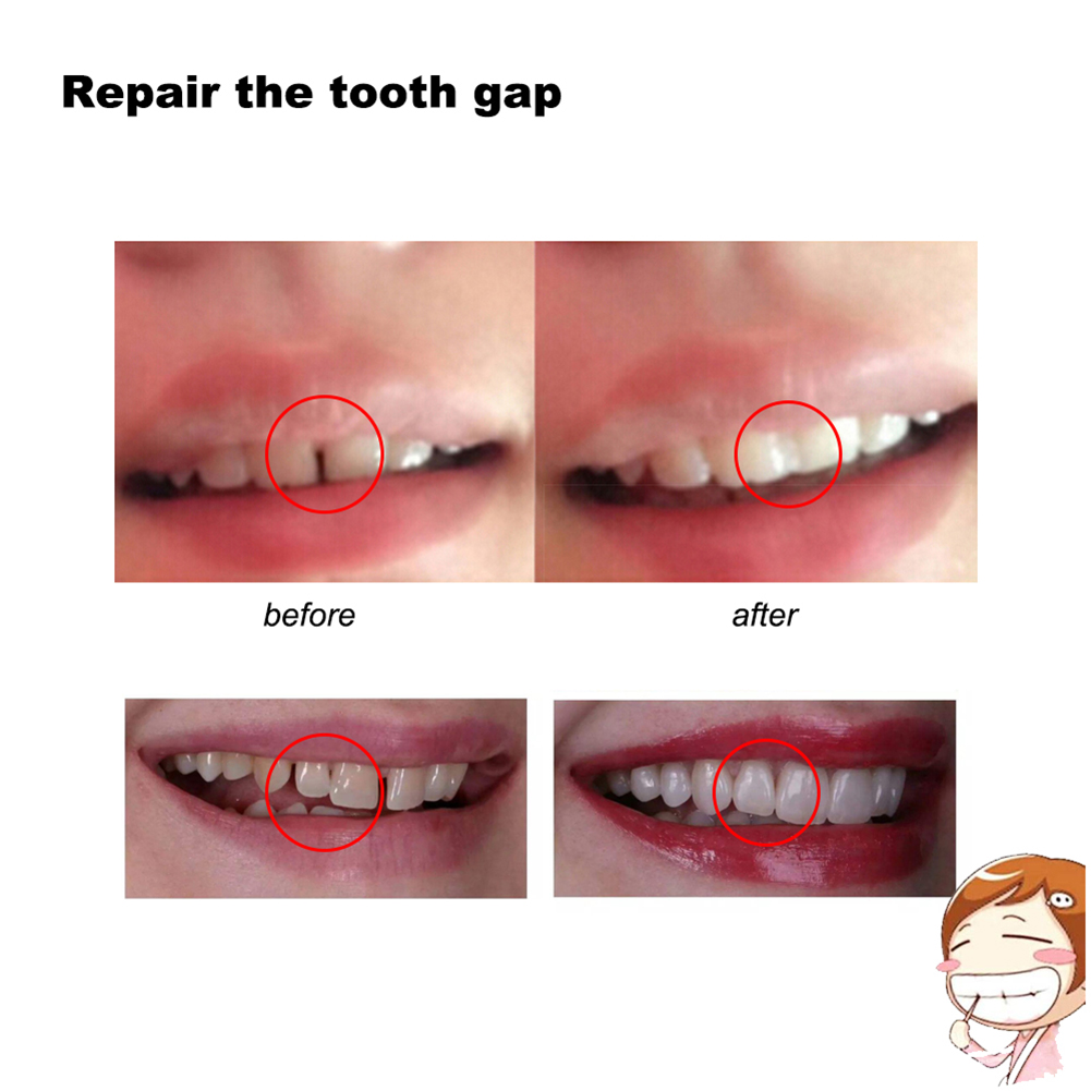 10/100g Dental Glue Handmade S - Teeth Whitening Session recensie en prijs