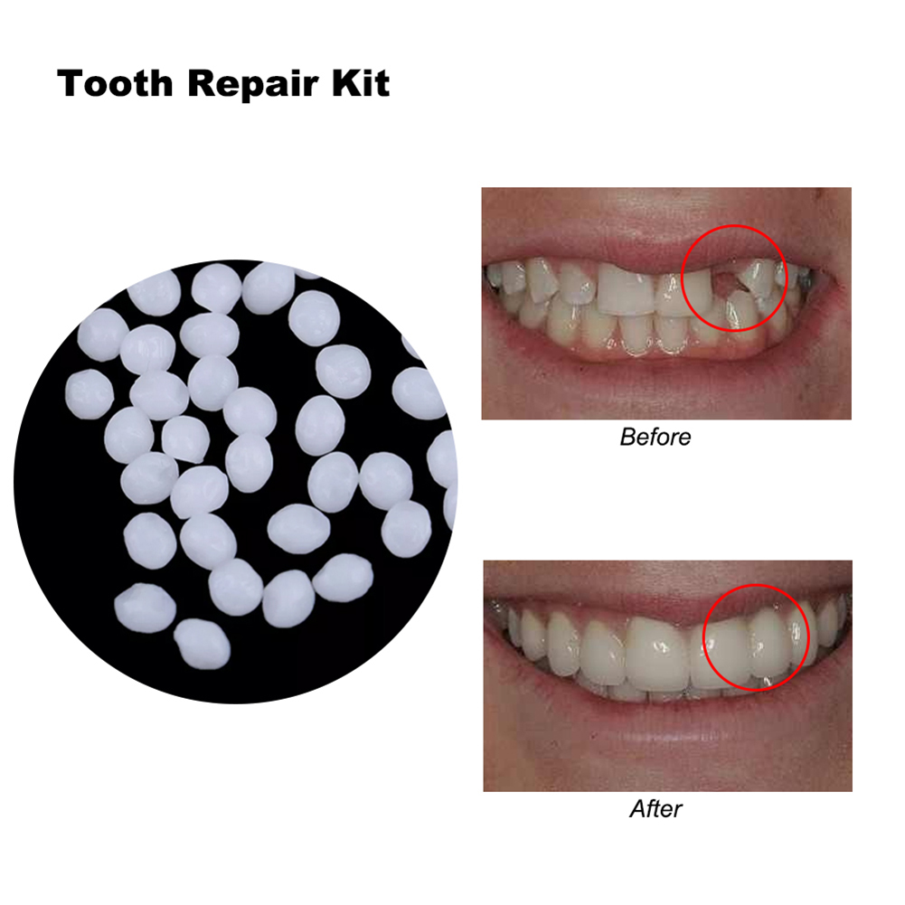 10/100g Dental Glue Handmade S - Teeth Whitening Session recensie en prijs