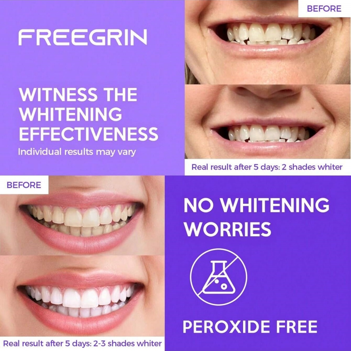 Deluxe Whitening Teeth Sticker - Teeth Whitening Strips Permanent recensie en prijs
