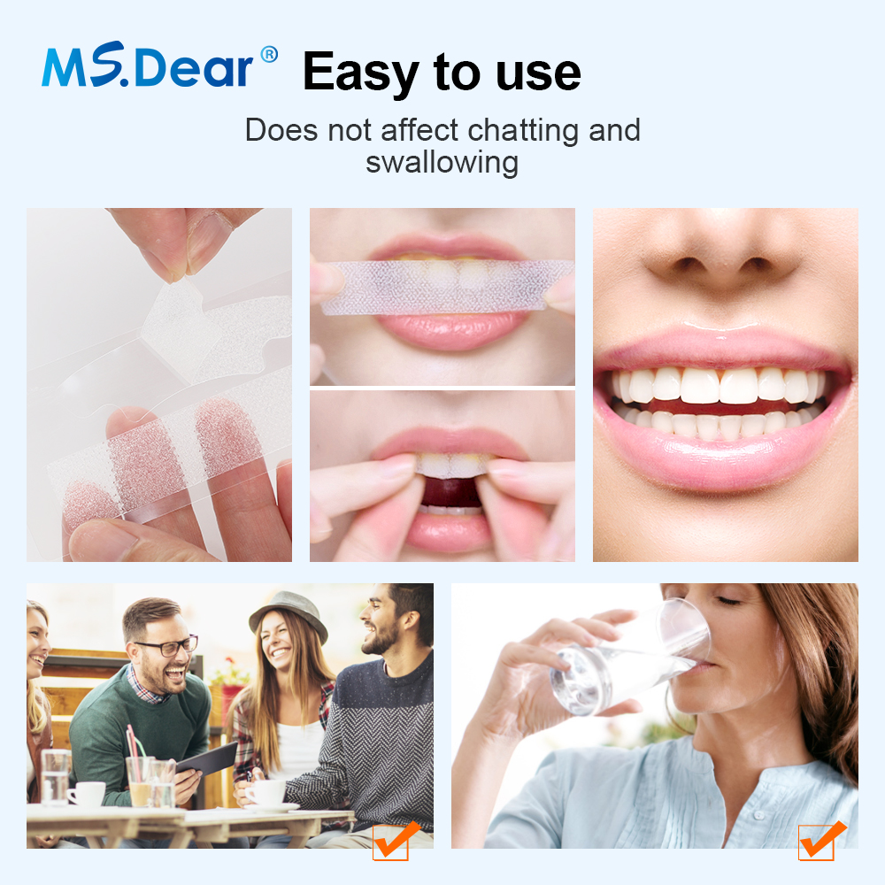 Teeth Whitening Strips Cleansi - Teeth Whitening Ai recensie en prijs